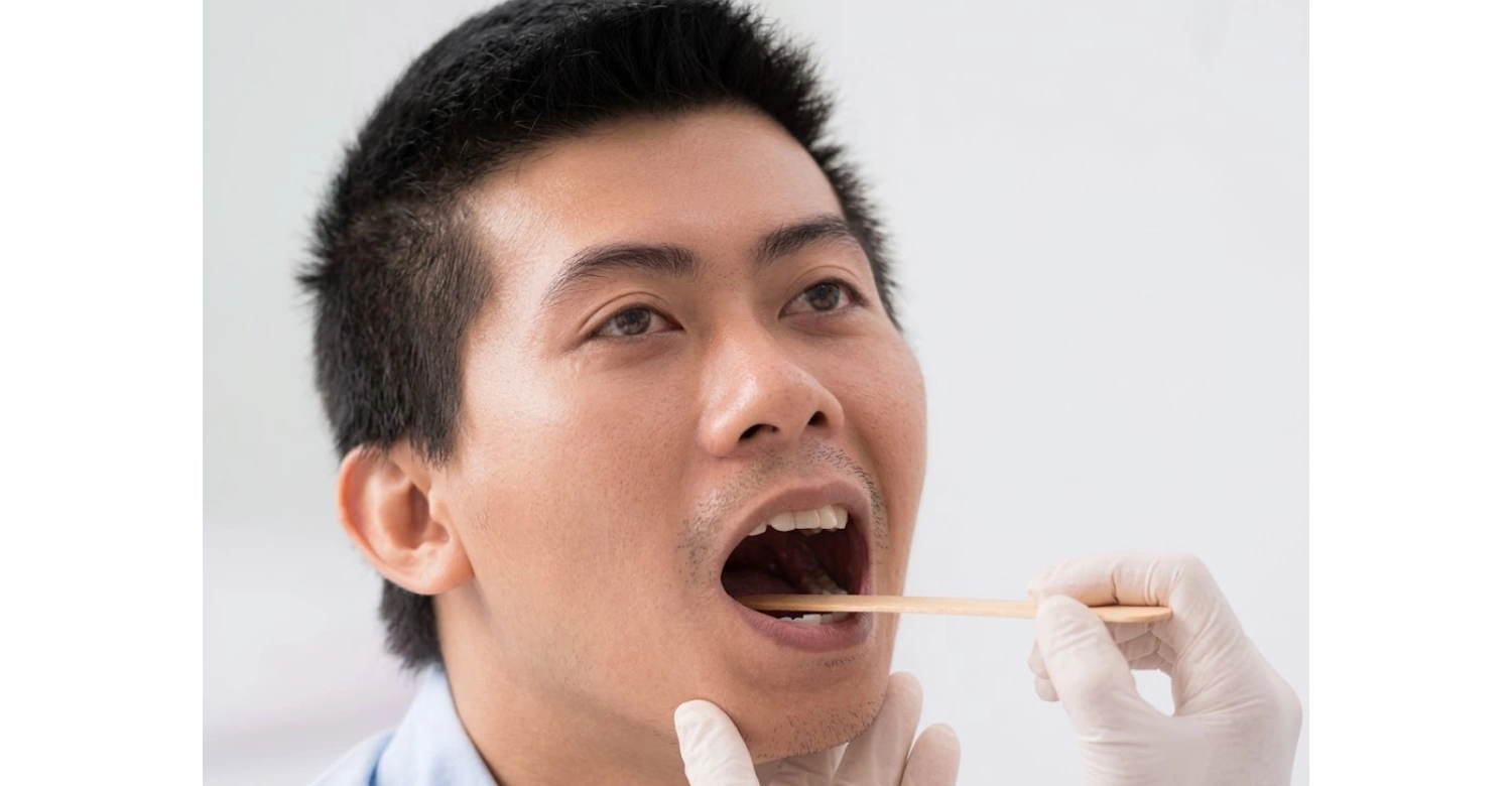 Tongue Function inblog